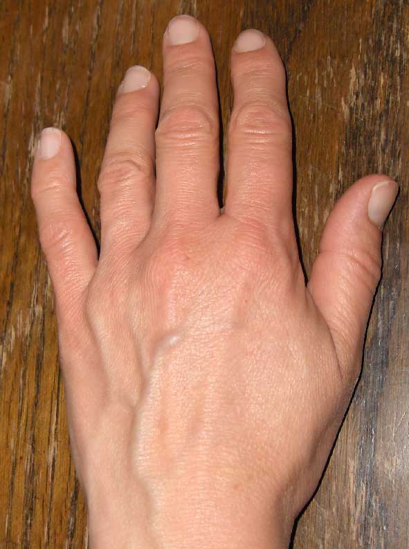 handl.jpg